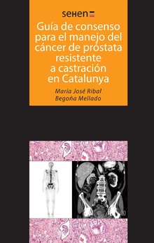 Guía de consenso para el manejo del cáncer de próstata resistente a castración en Catalunya